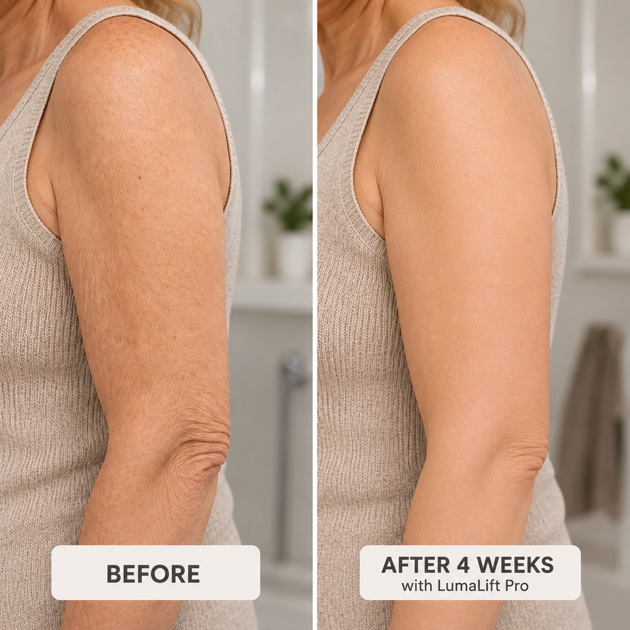 LumaLift Pro – 3-in-1 firming & massage device for face, arms & body